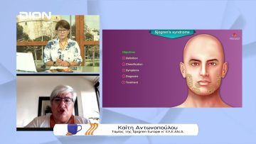 Τι πρέπει να ξέρουμε για το σύνδρομο sjogren | Ξεκινάμε Μαζί | 22/07/2022