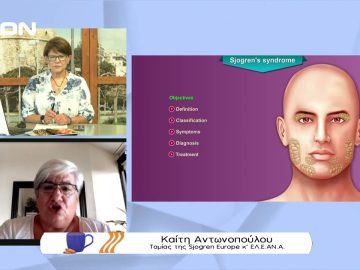 Τι πρέπει να ξέρουμε για το σύνδρομο sjogren | Ξεκινάμε Μαζί | 22/07/2022